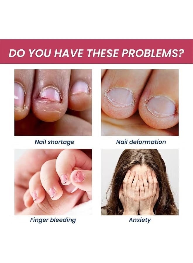 Lanthome Stop Nail Biting, Anti Nail Biting Polish, Clear Varnish to Discourage Nail Biting and Thumb Sucking for Kids and Adults, Plant Extracts (15ml) - Image 2